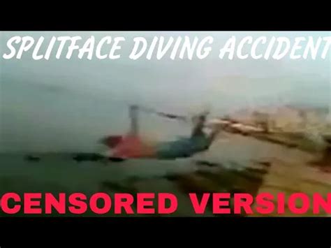 Split Face Diving Accident: A Tale of Warning - fixthelife