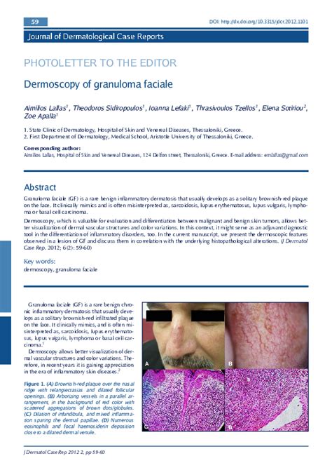 (PDF) Dermoscopy of granuloma faciale | Aimilios Lallas - Academia.edu