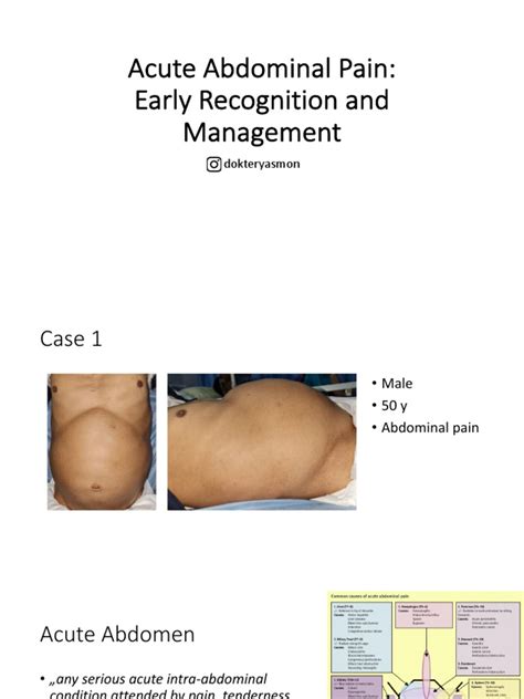 Acute Abdomen | PDF | Diseases And Disorders | Clinical Medicine