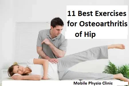 11 Best Exercises for Hip Osteoarthritis - Mobile Physio