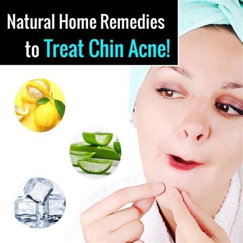 chin-acne-remedies | Chin acne remedies, Chin acne, Natural acne remedies