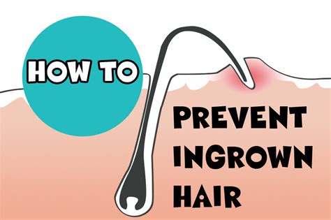 Ingrown Hair Prevention - Modern Design Ideas - Human Hair Exim