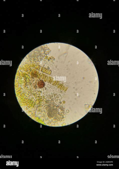 Algae under the microscope Stock Photo - Alamy