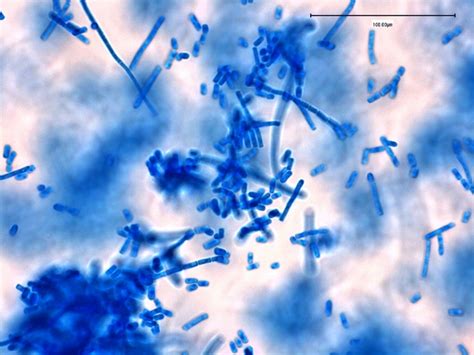 Fun With Microbiology (What's Buggin' You?): Geotrichum candidum