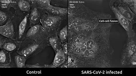 Nanolive imaging suggests that cell-cell fusion could play a key role ...