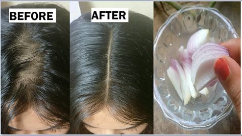 Can Coconut Oil Help Your Hair Grow | Examples and Forms