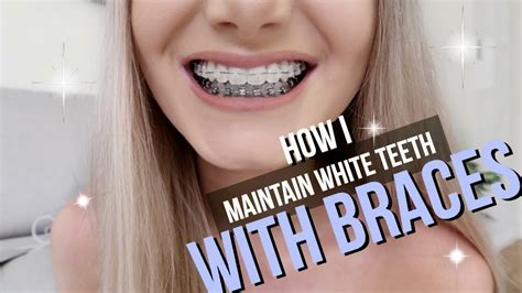 How To Keep Teeth White With Braces - Informationwave17