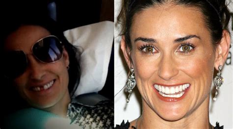 Demi Moore Reveals She's Missing Her Two Front Teeth, So How Did It Happen?