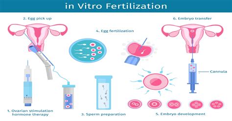 IVF Treatment Procedure Step By Step | Dr Mona Dahiya