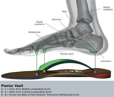 Arch Support | Best Arch Support for the 3 Arches in Your Feet