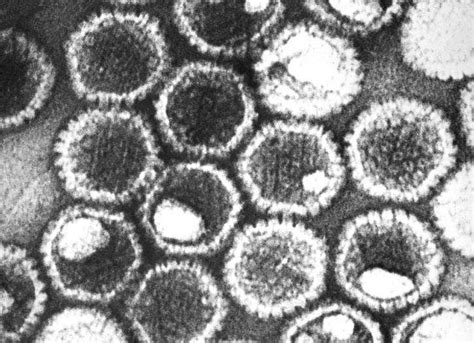 Herpes virus' molecular structure uncovered in Glasgow University study