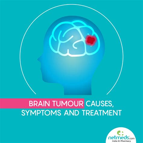 Brain Tumor: Causes, Symptoms And Treatment