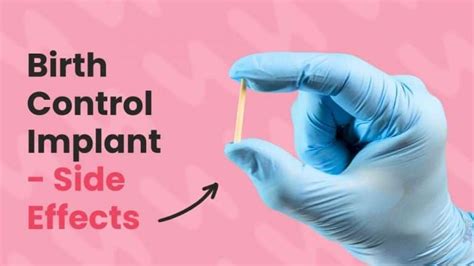 Birth Control Implant Side Effects: Exploring the Potential Impact