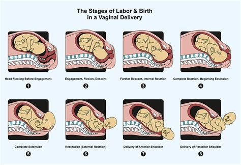 Natural Delivery - Stages, Benefits & Preparation Tips