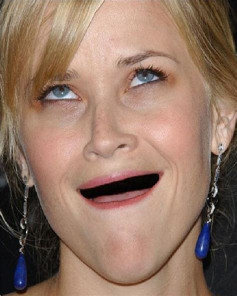 Reese Witherspoon-Celebs Without Teeth