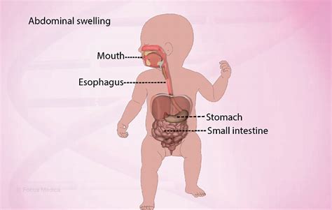 Health Condition : Symptoms, Causes, Treatment and More