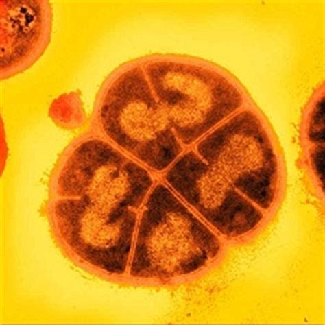 Deinococcus radiodurans NEU2012 - microbewiki