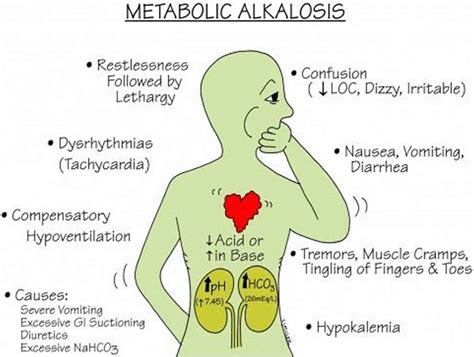 Metabolic alkalosis, definition, causes, symptoms, diagnosis, treatment ...