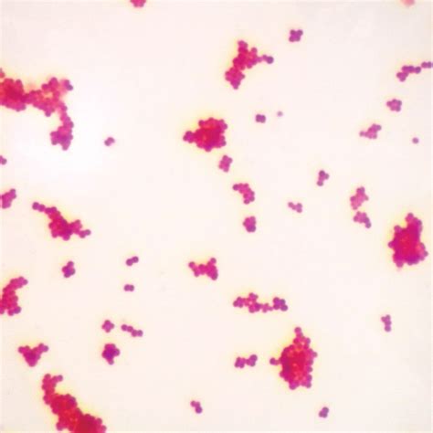 Buy Gram-Negative Coccus, w.m. Gram Stain Microscope Slide Online at ...