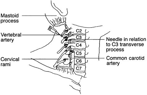 Cervical Plexus Model