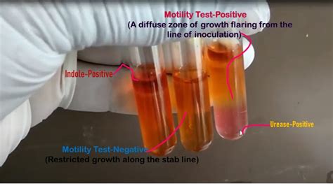 Motility Test: Introduction, Principle, Composition, Procedure, Result