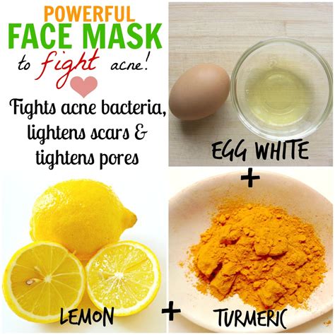 DIY Homemade Face Masks for Acne (How to Stop Pimples Naturally ...