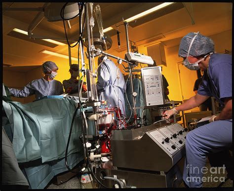 Heart Bypass Surgery With Heart-lung Machine Photograph by Deep Light Productions/science Photo ...