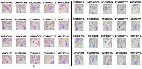 Diagnostics | Free Full-Text | Blood Slide Image Analysis to Classify WBC Types for Prediction ...