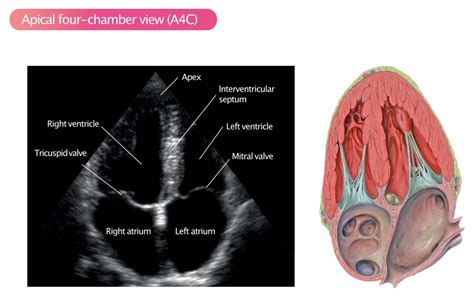 Standard Transthoracic Echocardiogram: Complete Imaging Protocol – ECG & ECHO