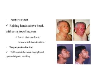 Thyroid gland123 | PPT