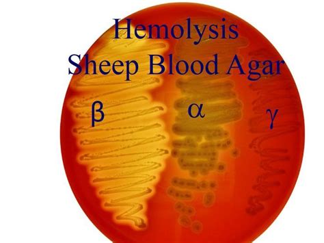 hemolysis microbiology test - Google Search Technology Lab, Medical Technology, Science Geek ...