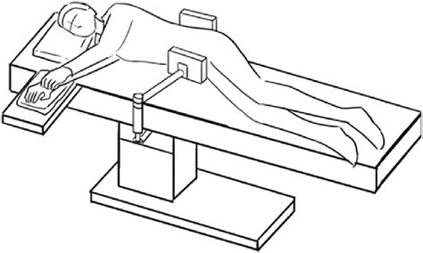 Surgical position used for the WatsoneJones approach. The lateral... | Download Scientific Diagram