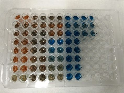 Difference Between Bradford and Lowry Protein Assay | Compare the ...