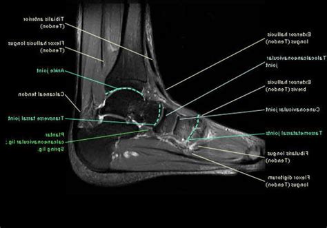 MRI Ankle Anatomy | Foot anatomy, Ankle anatomy, Anatomy