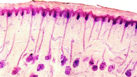 Skin Sweat Glands Photograph by Dr Keith Wheeler/science Photo Library