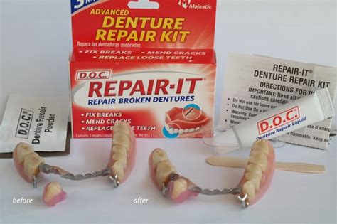 Denture Repair: Denture Repair With Super Glue