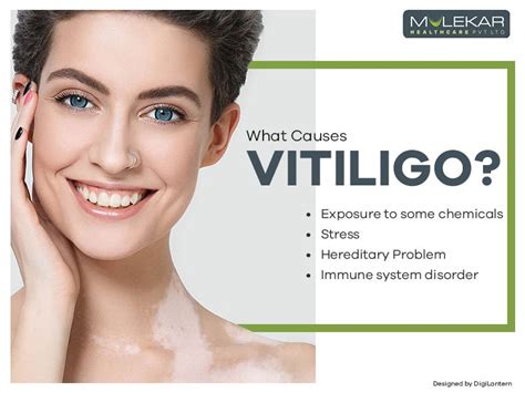 Vitiligo — Causes, Symptoms and Treatment | by Sanjeev Sharma | Medium