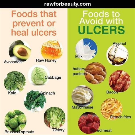 Foods To Eat And Avoid For Stomach Ulcers Foods For Ulcers Stomach | My XXX Hot Girl