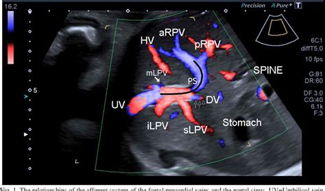 Portal Vein Anatomy Ultrasound