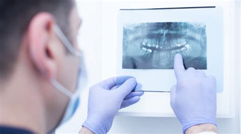 Film vs. Digital Panoramic Dental X-ray Machines