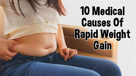 10 Medical Causes Of Rapid Weight Gain - YouTube