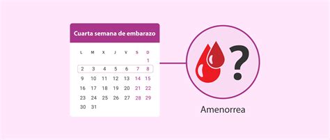 Retraso menstrual o amenorrea y embarazo