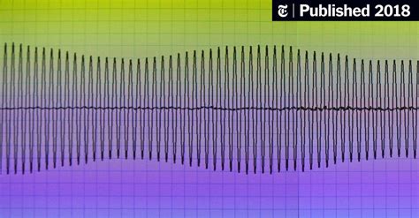 Yanny or Laurel? How a Sound Clip Divided America - The New York Times