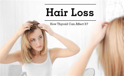 Thyroid hair loss treatment clinic Lahore Pakistan | Free checkup