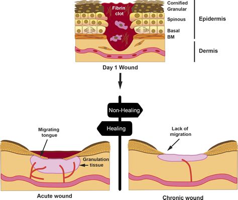 Granulation Tissue Wound Healing