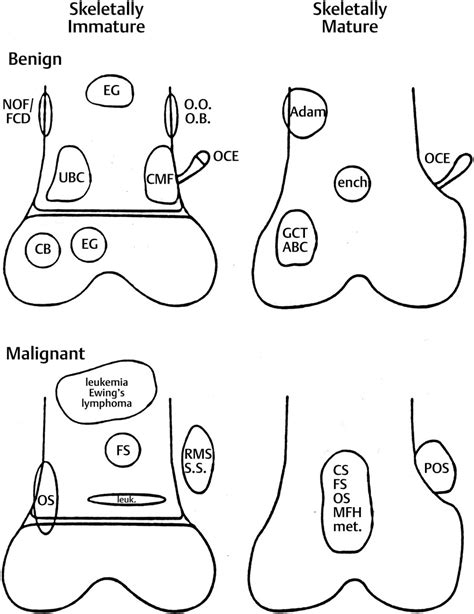 Miscellaneous Disorders of Growth and Development | Musculoskeletal Key