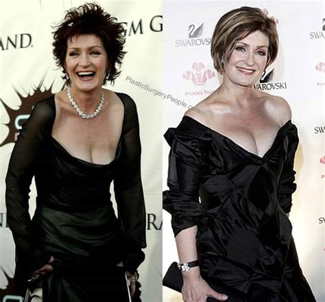 Sharon Osbourne: BEFORE and AFTER