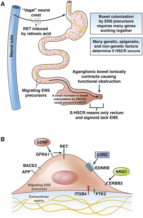 Even When You Know Everything, There Is Still More to Learn About Hirschsprung Disease ...