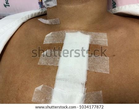 Surgical Dressing Stock Images, Royalty-Free Images & Vectors ...