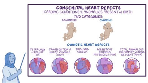 Congenital Heart Defects In Children Types Causes Sym - vrogue.co